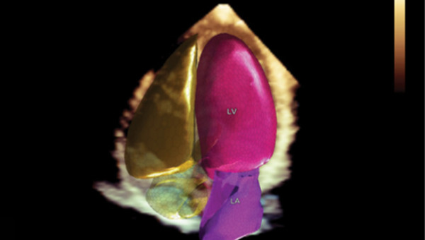 Heart Model